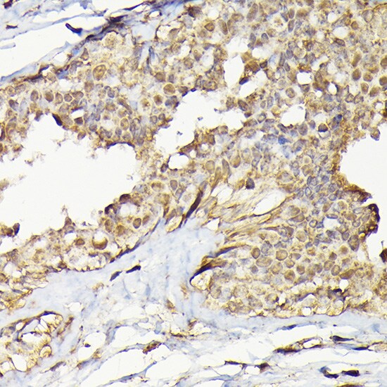 TRBP Antibody