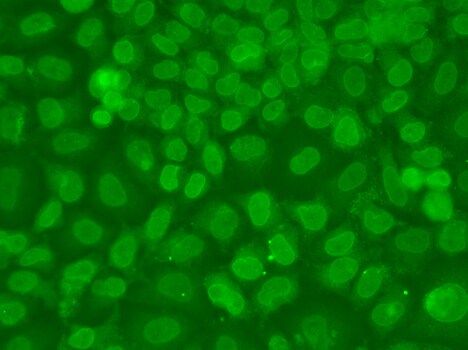 TRBP Antibody