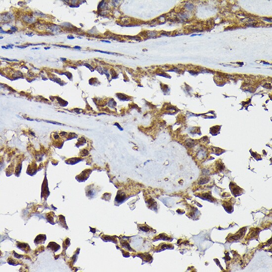 TRBP Antibody