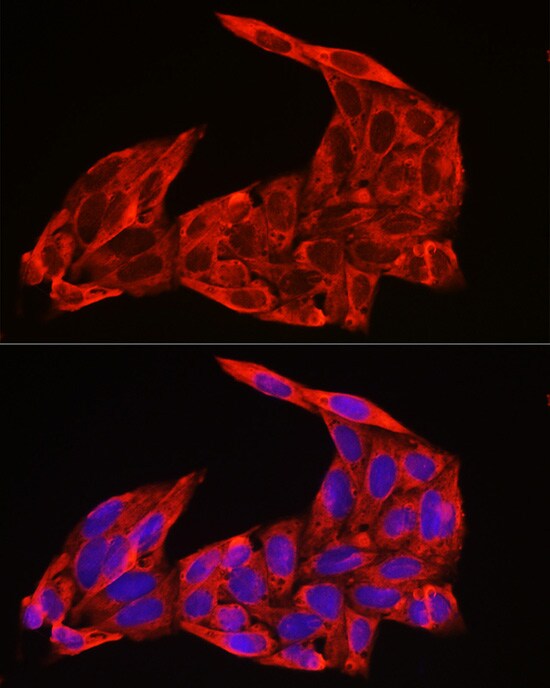 NRAS Antibody