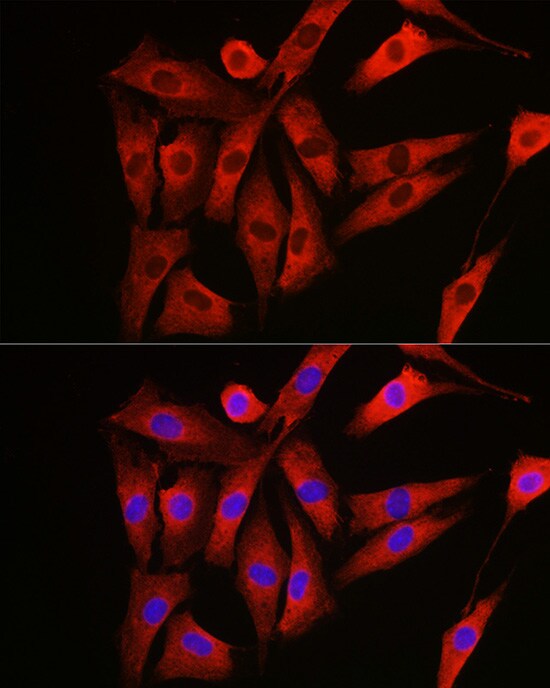 NRAS Antibody