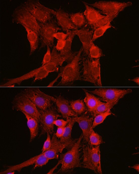 NRAS Antibody