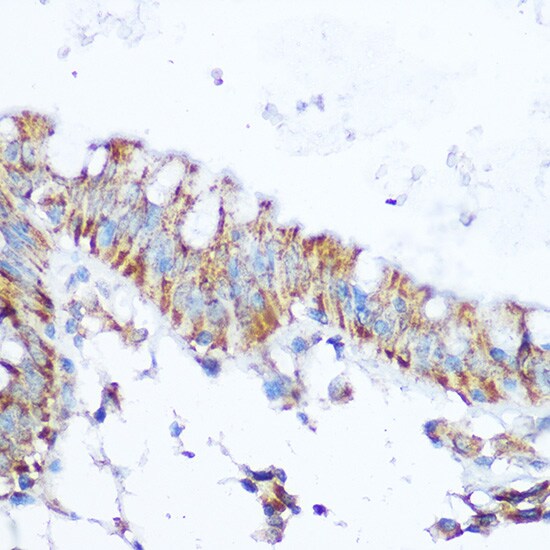 SIRT4 Antibody