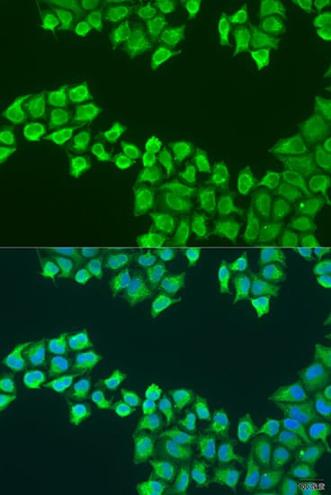 ATP5F1 Antibody