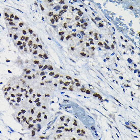 DRIL1 Antibody