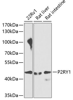 P2Y1/P2RY1 Antibody