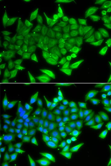 TTF2 Antibody