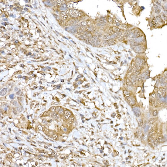 SOCS-1 Antibody