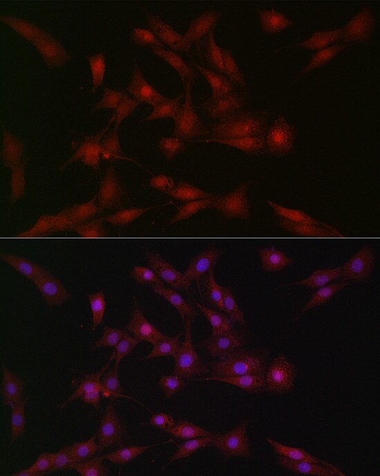 SOCS-1 Antibody