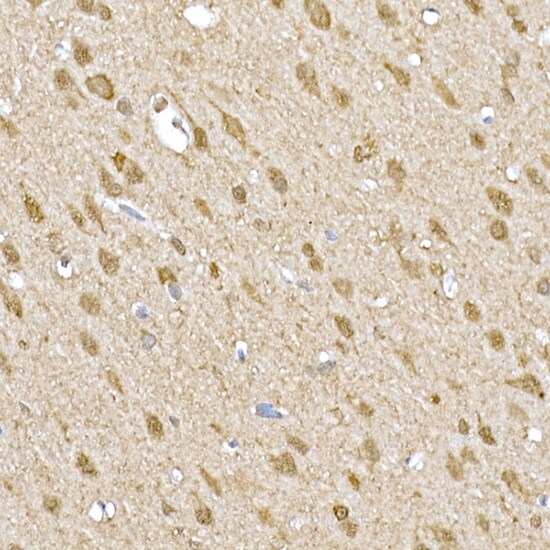 SOCS-1 Antibody