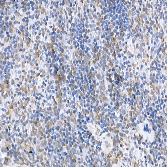 SOCS-1 Antibody