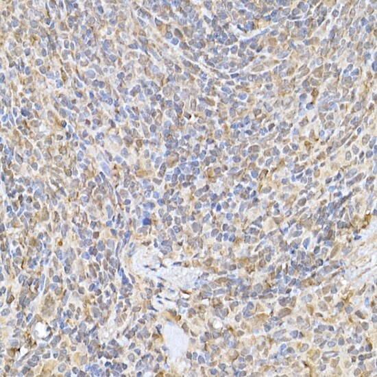 SOCS-1 Antibody