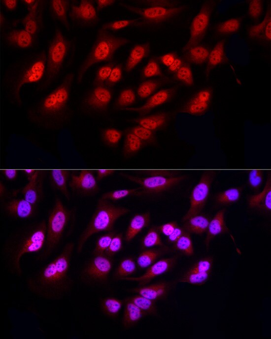 FBXW11 Antibody