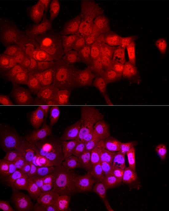 FBXW11 Antibody