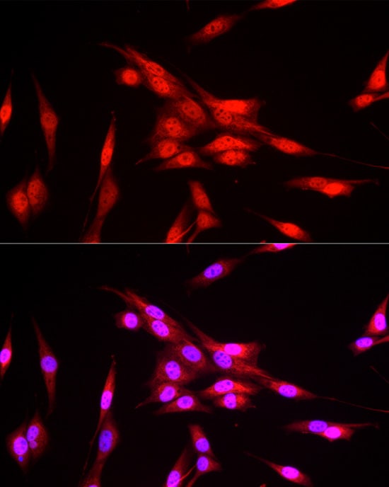 FBXW11 Antibody