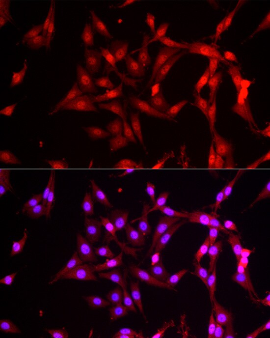 FBXW11 Antibody