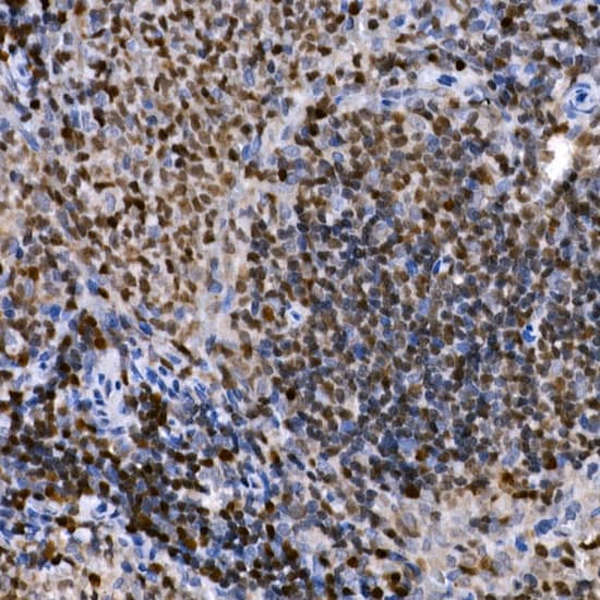 PHF11 Antibody