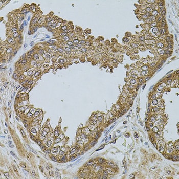 CHRFAM7A Antibody