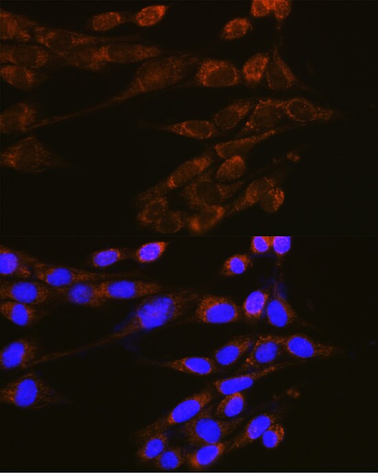 Dynamin 2 Antibody