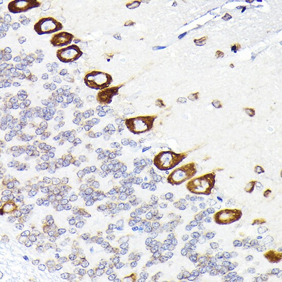 EEF1G Antibody