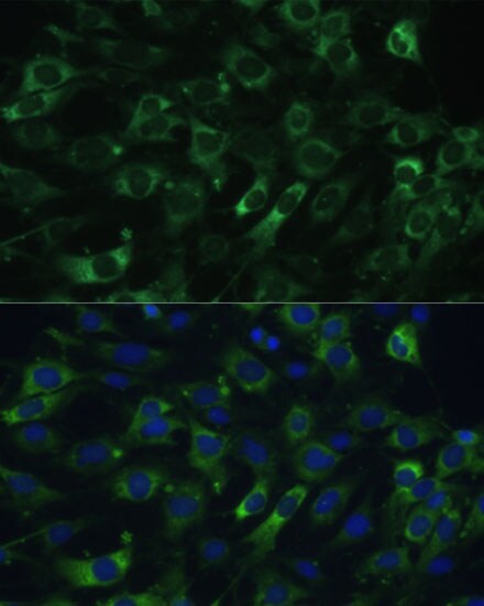 EEF1G Antibody