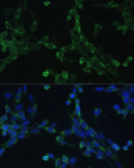 EEF1G Antibody