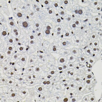 TFII-I Antibody