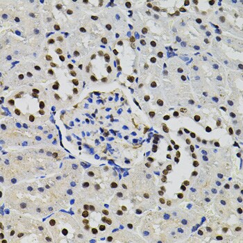 TFII-I Antibody