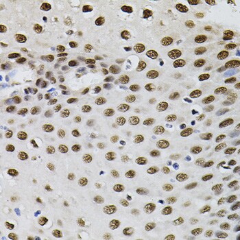TFII-I Antibody