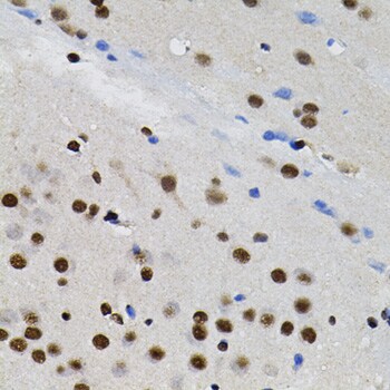 TFII-I Antibody