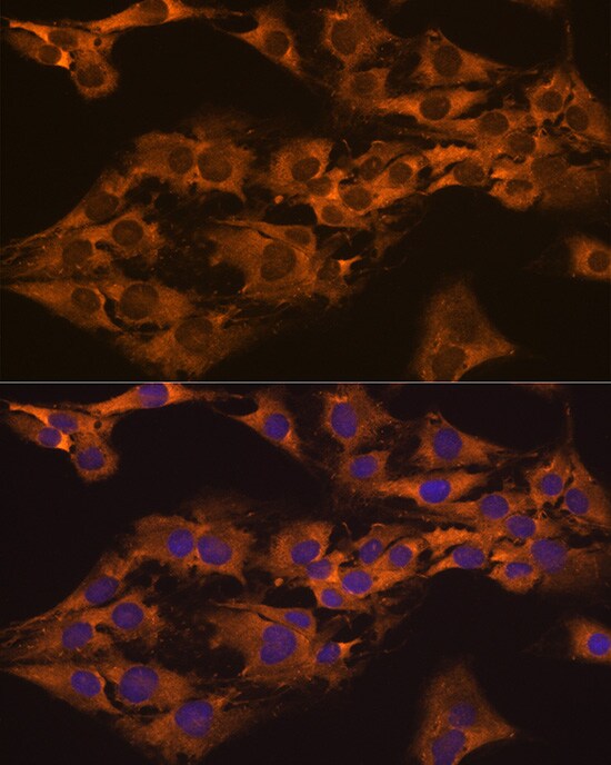 GPIP137 Antibody