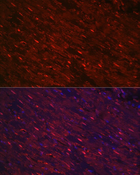 PGAM2 Antibody
