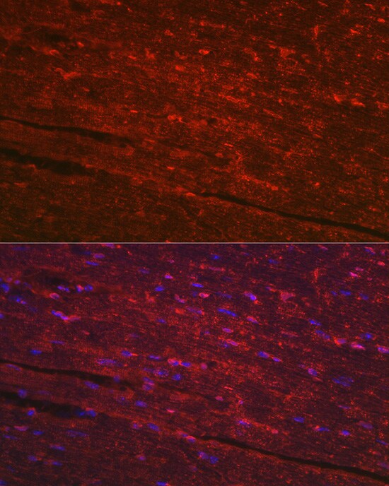 PGAM2 Antibody
