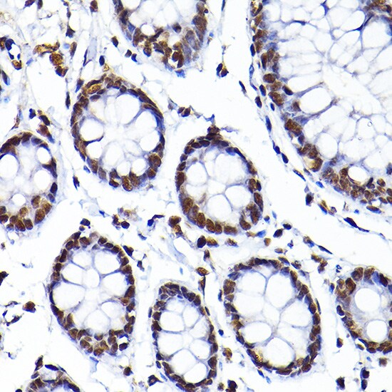 SAFB Antibody