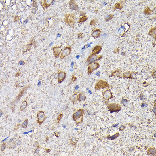MTHFD1L Antibody