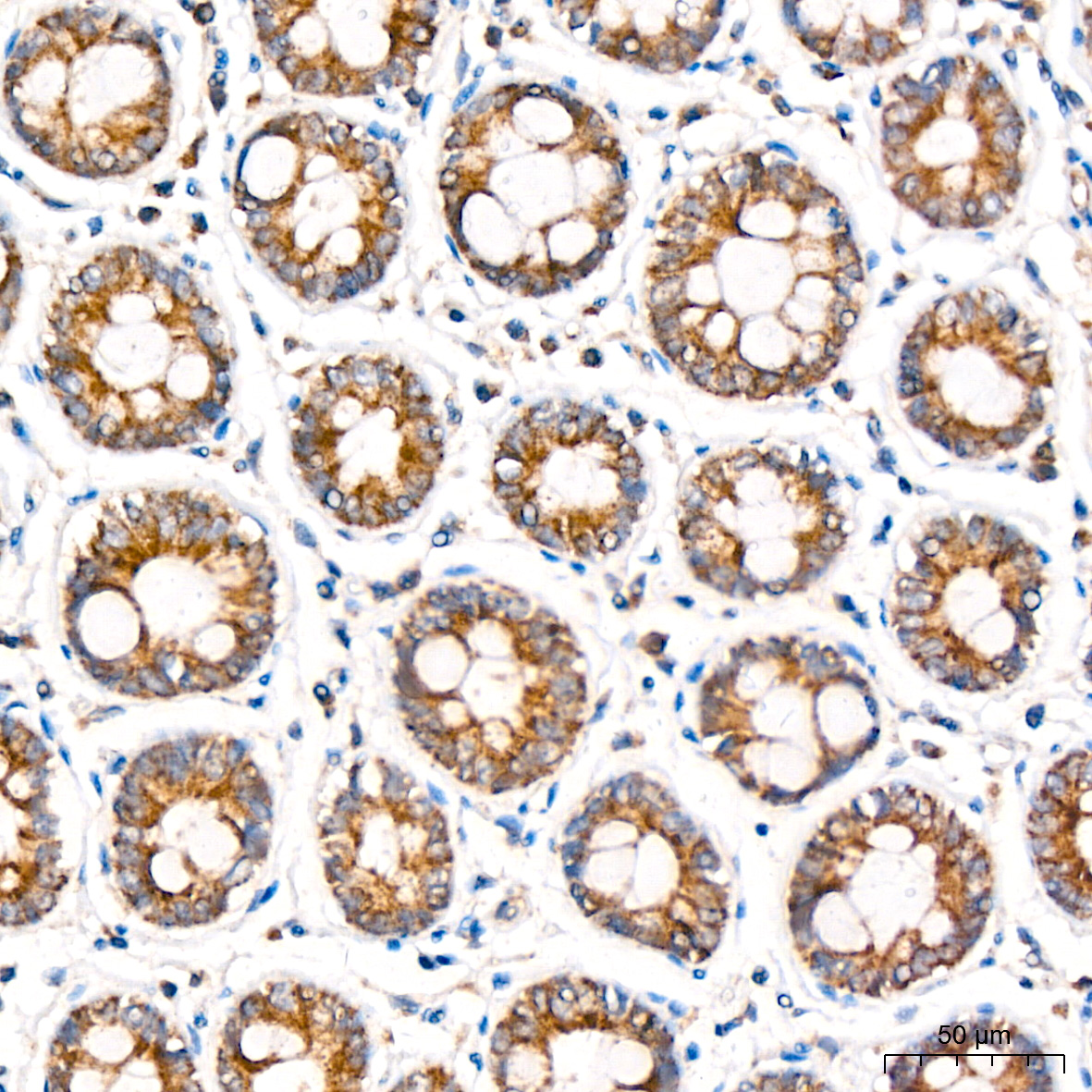MCCC2 Antibody