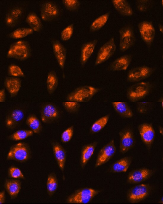 GRID1 Antibody