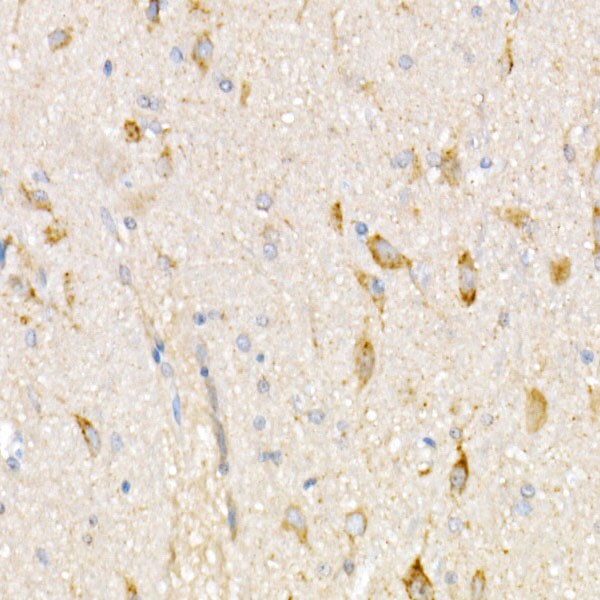 NDUFV1 Antibody