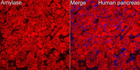 Pancreatic Amylase Alpha Antibody