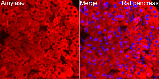 Pancreatic Amylase Alpha Antibody