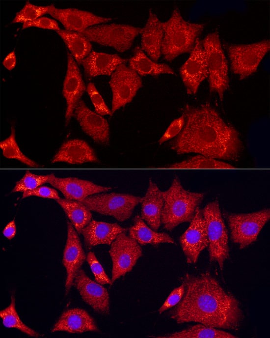 SLC25A11 Antibody