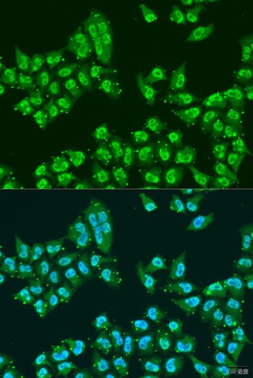 hHpr1-p84-Thoc1 Antibody