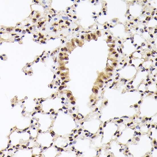 hHpr1-p84-Thoc1 Antibody
