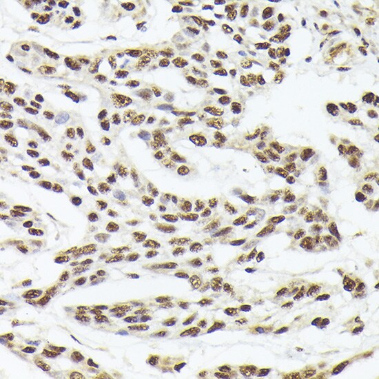 hHpr1-p84-Thoc1 Antibody