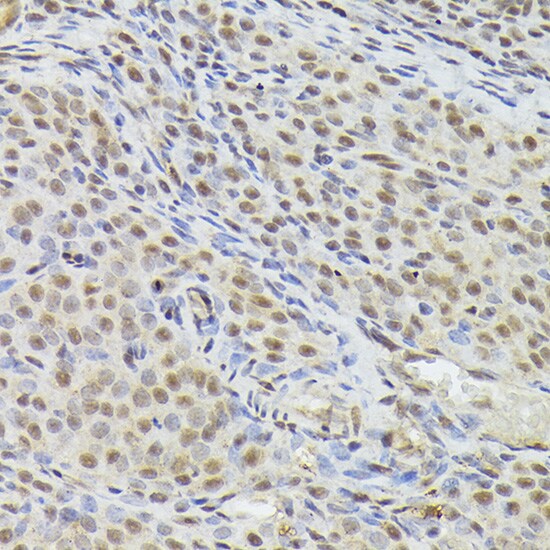 hHpr1-p84-Thoc1 Antibody