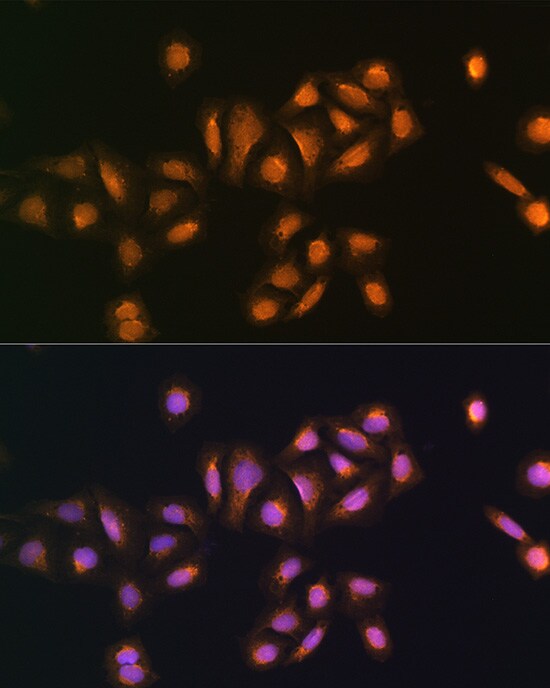 STK38 Antibody