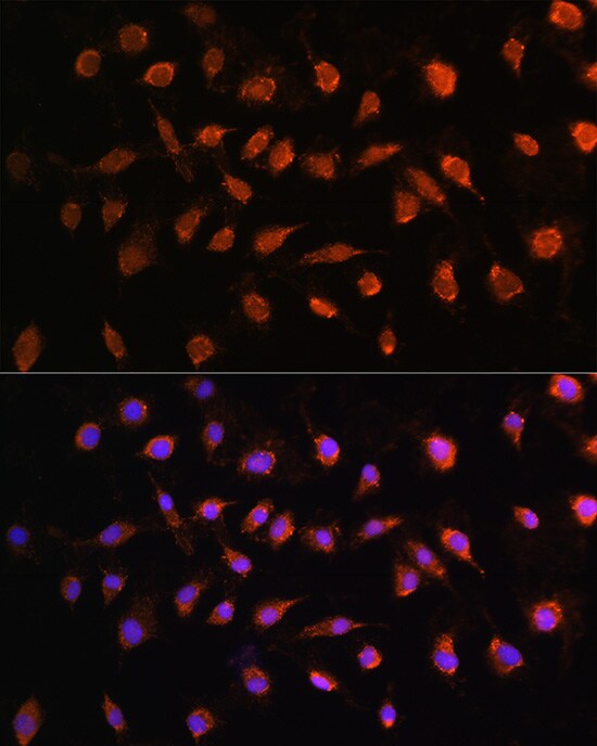 STK38 Antibody