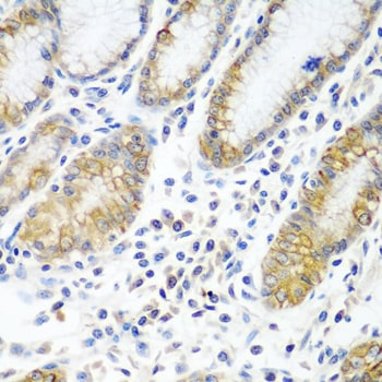 ATAD3A Antibody