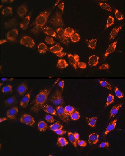 TRIM23 Antibody