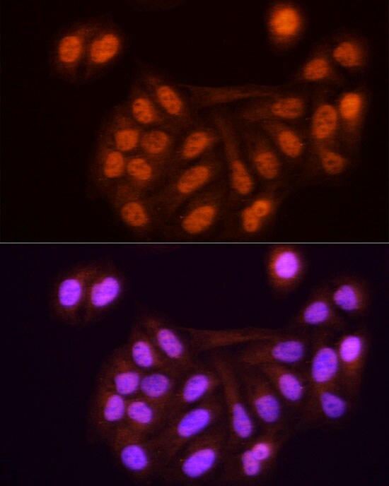 KPNA3 Antibody
